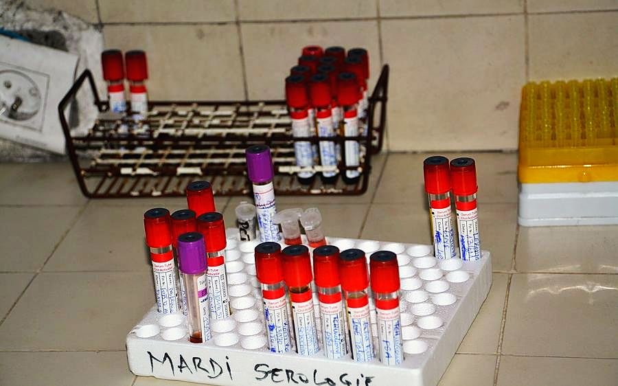Sample collection on site