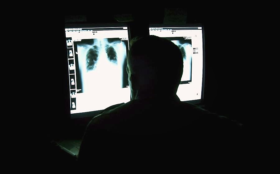 X-ray
